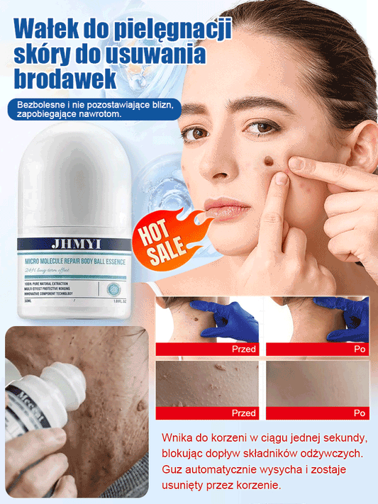 Wałek do pielęgnacji skóry do usuwania brodawek
