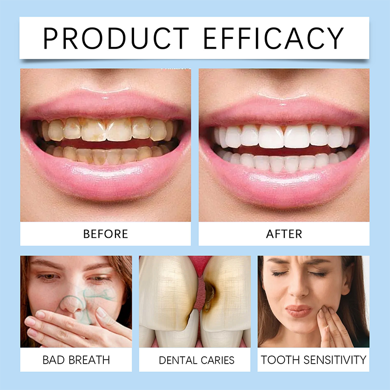 🦷 Najważniejsza rada dentystów — żel do naprawy zębów